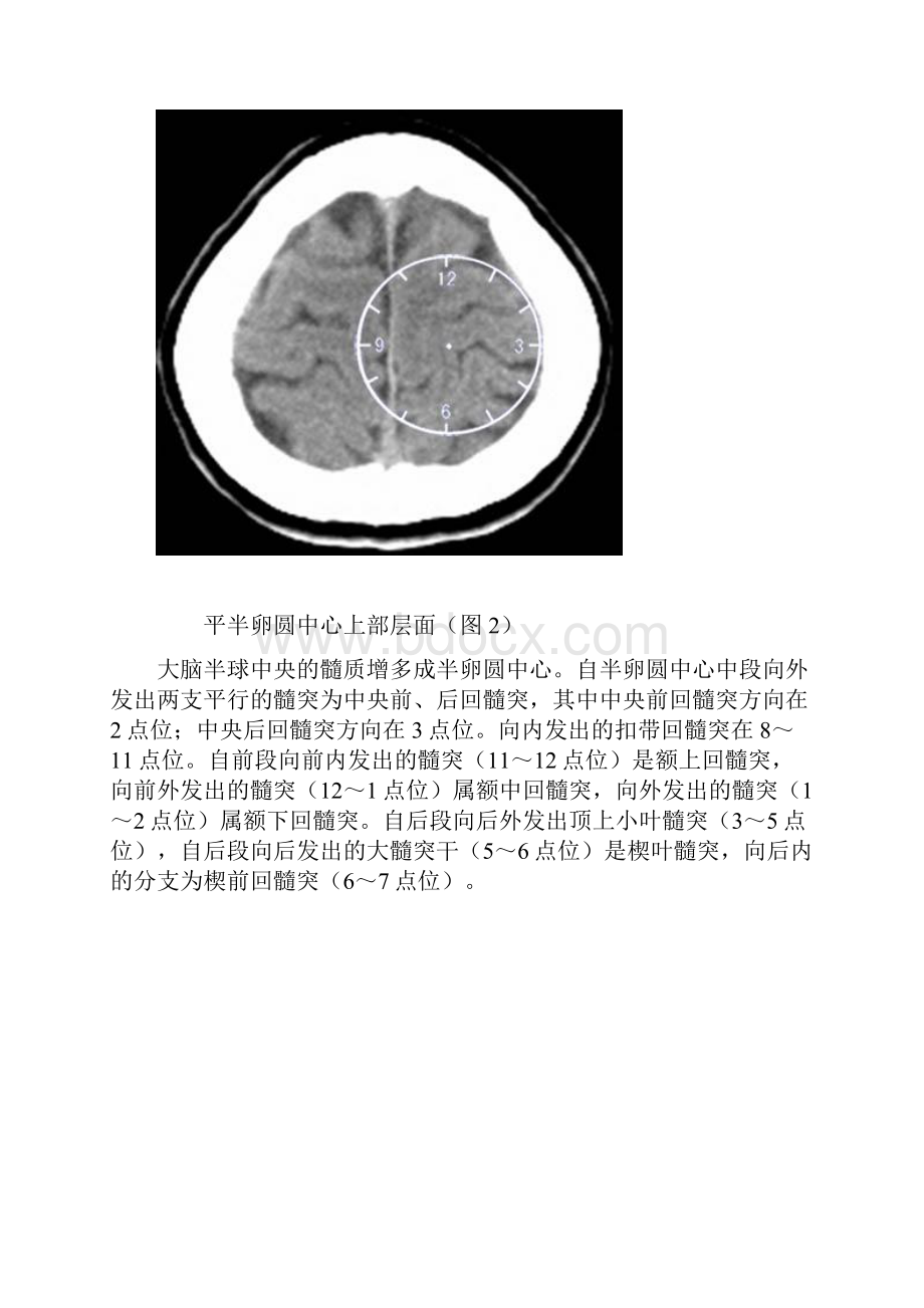 脑池断层影像解剖.docx_第2页