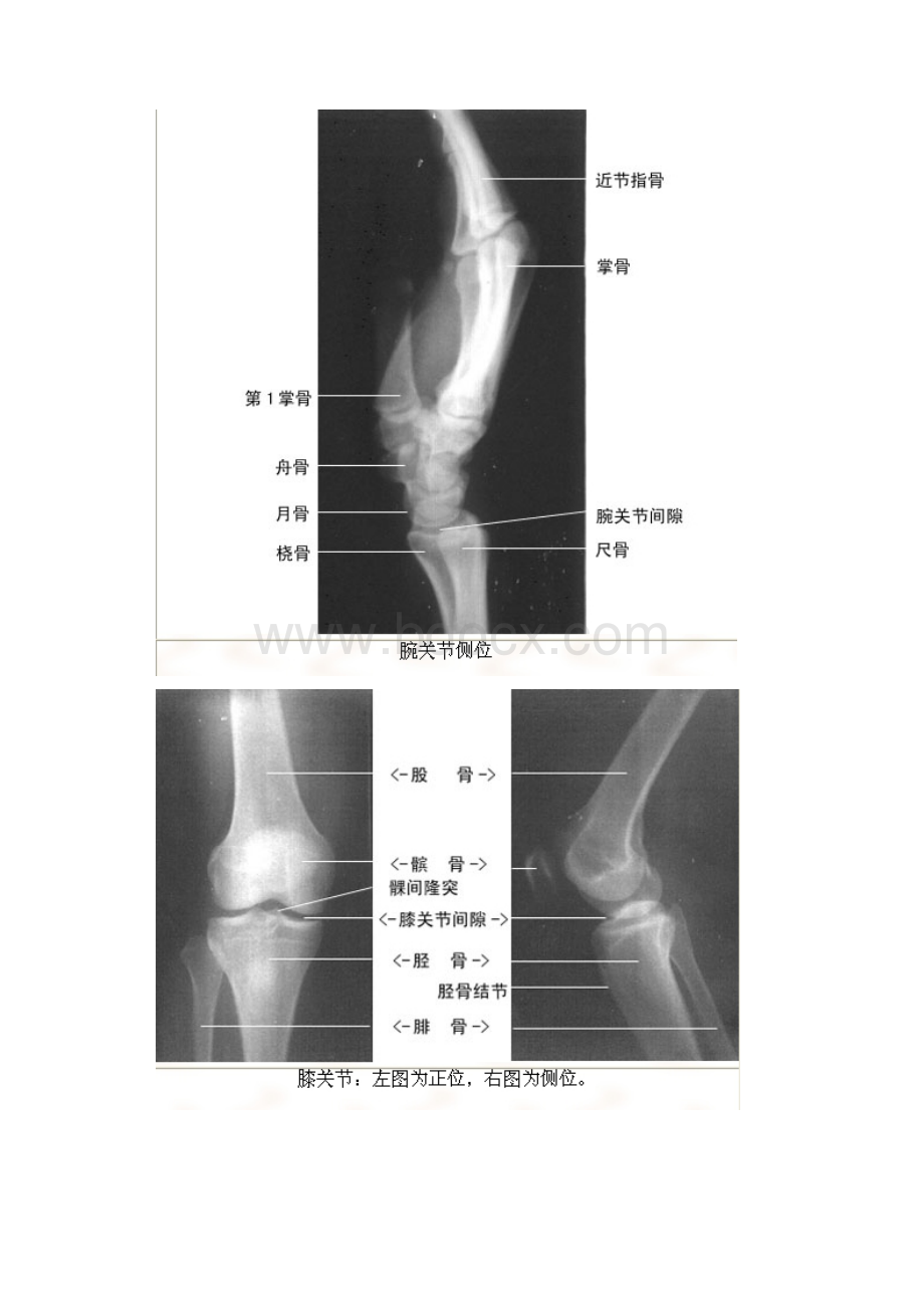 影像解剖影像图谱珍藏版.docx_第2页