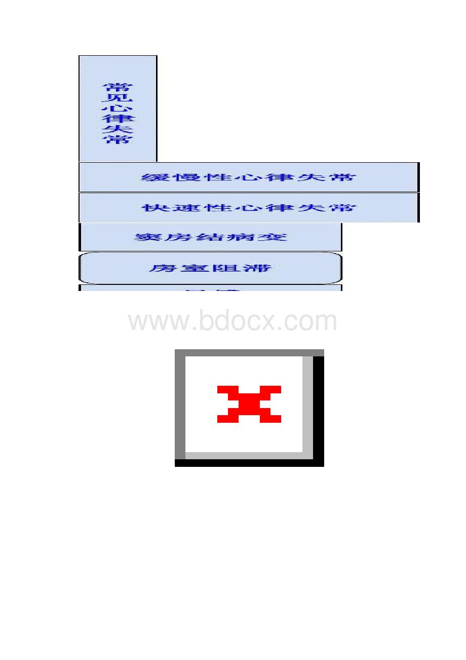 常见异常心电图精.docx_第3页