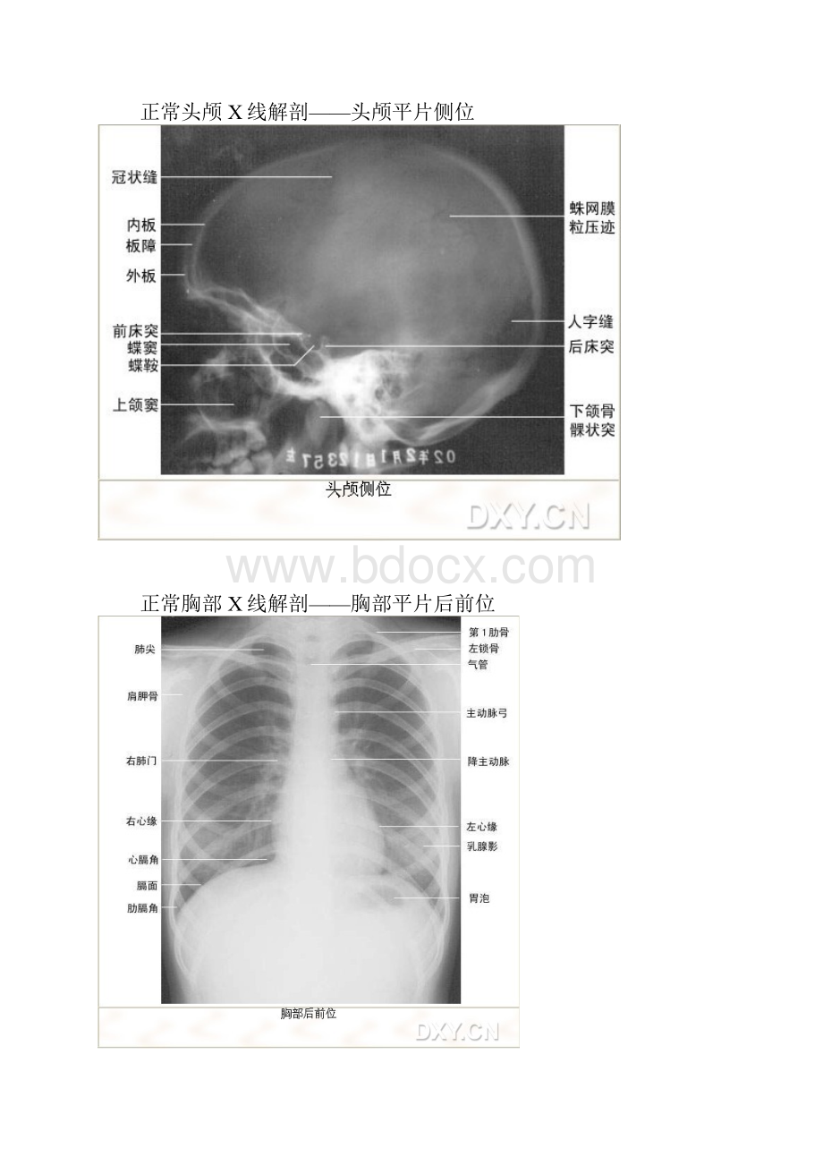 X线正常解剖Word下载.docx_第2页