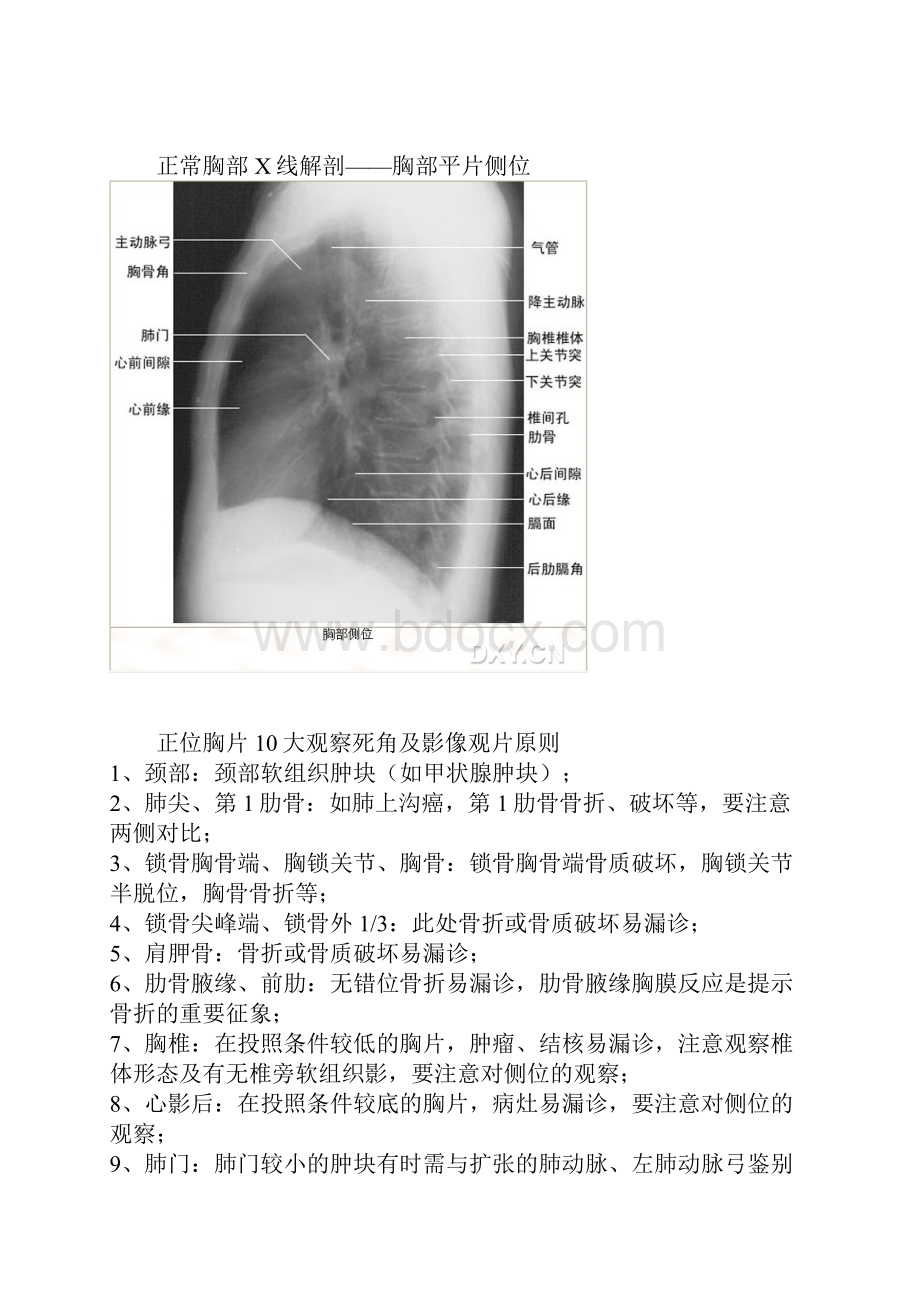 X线正常解剖Word下载.docx_第3页