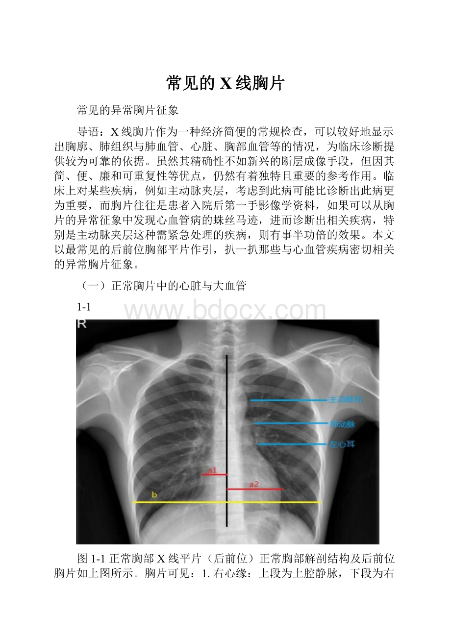 常见的X线胸片Word下载.docx_第1页