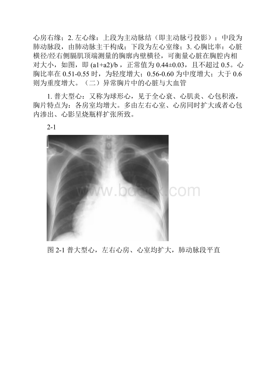 常见的X线胸片Word下载.docx_第2页