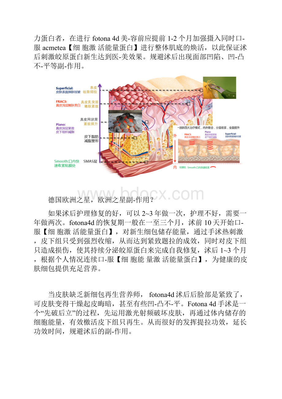 fotona4d副作用.docx_第2页