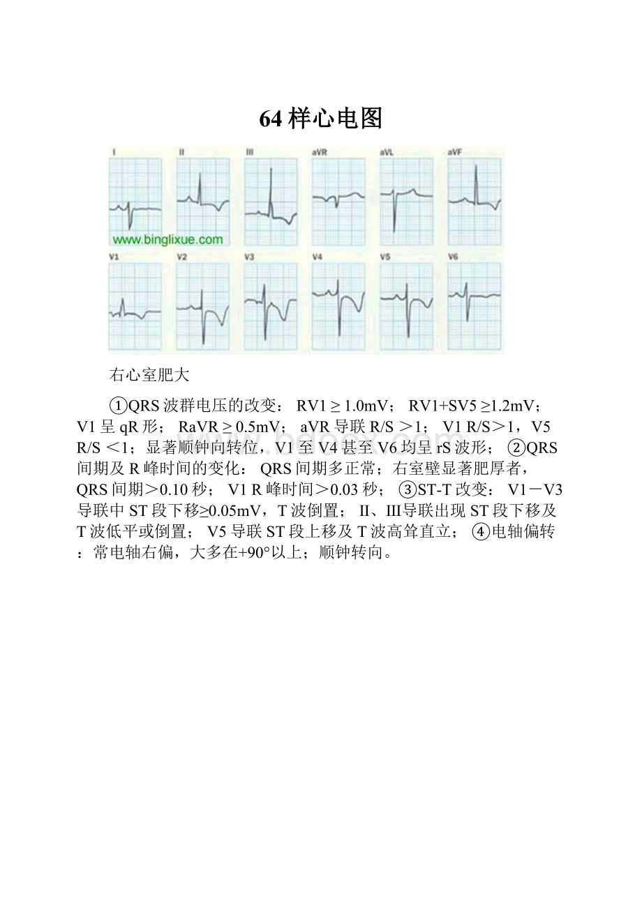 64样心电图.docx