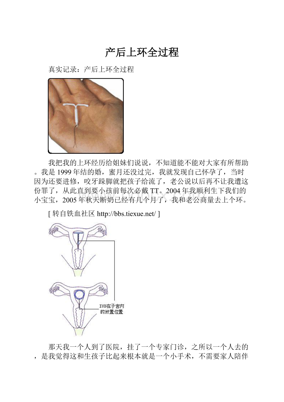 产后上环全过程.docx