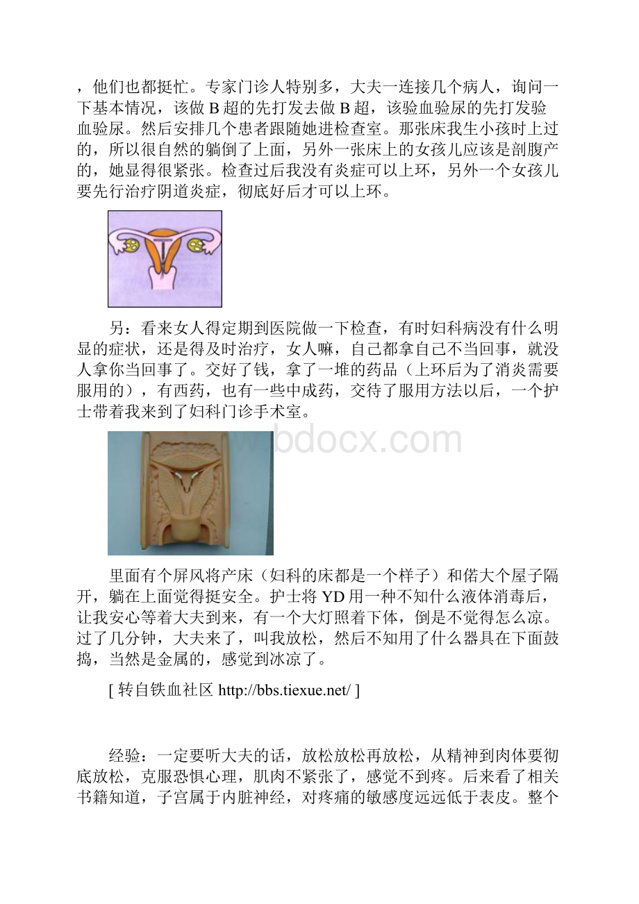 产后上环全过程.docx_第2页