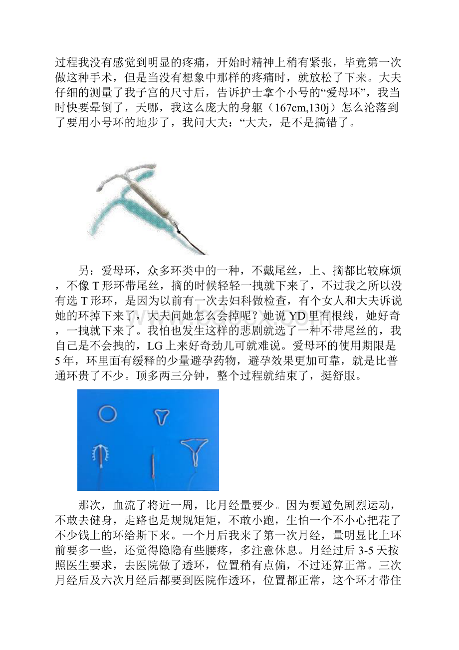 产后上环全过程.docx_第3页