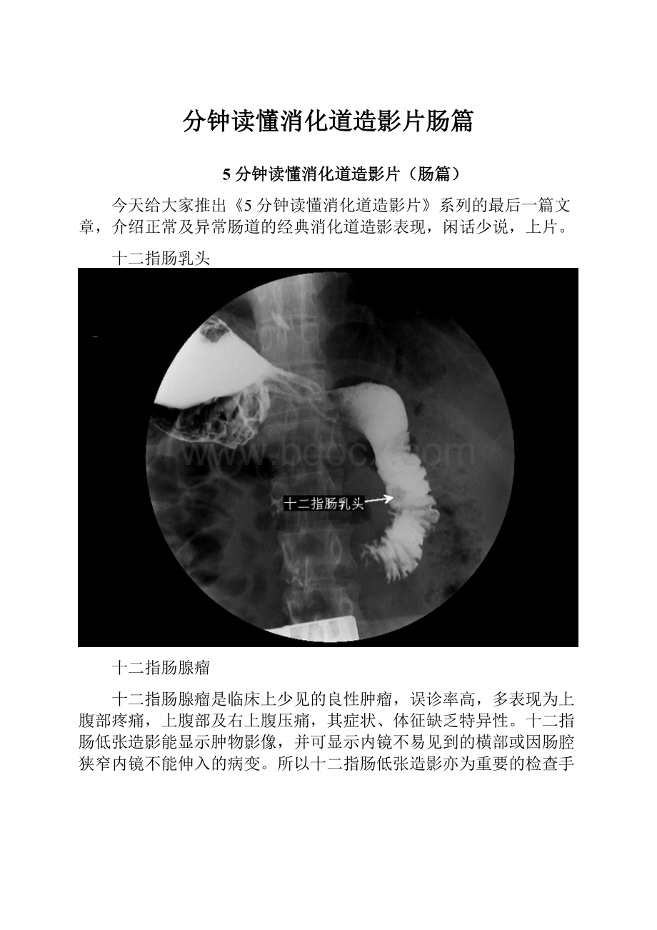 分钟读懂消化道造影片肠篇.docx