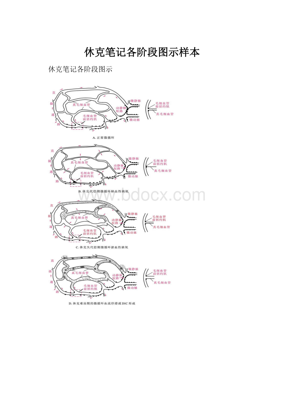 休克笔记各阶段图示样本.docx