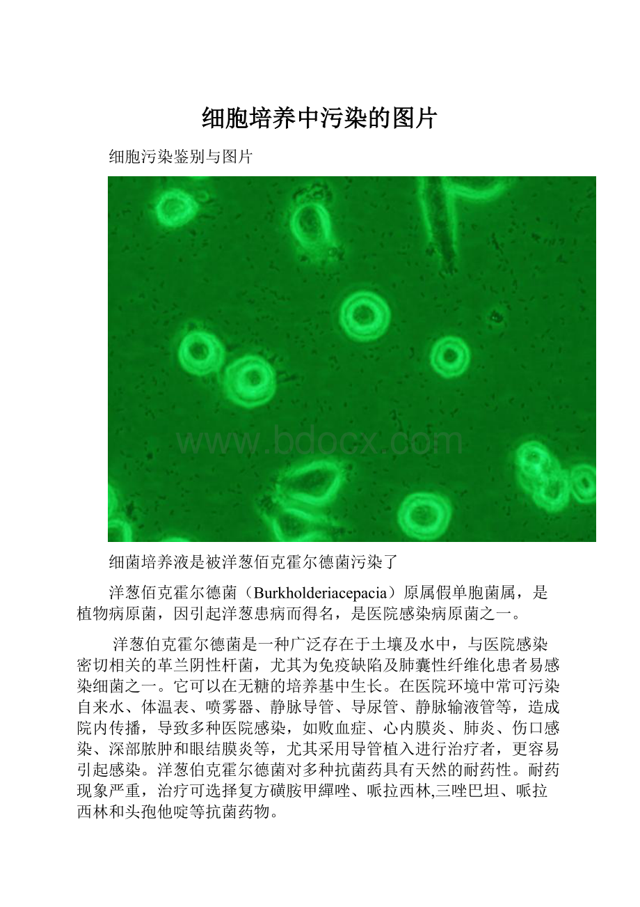 细胞培养中污染的图片.docx