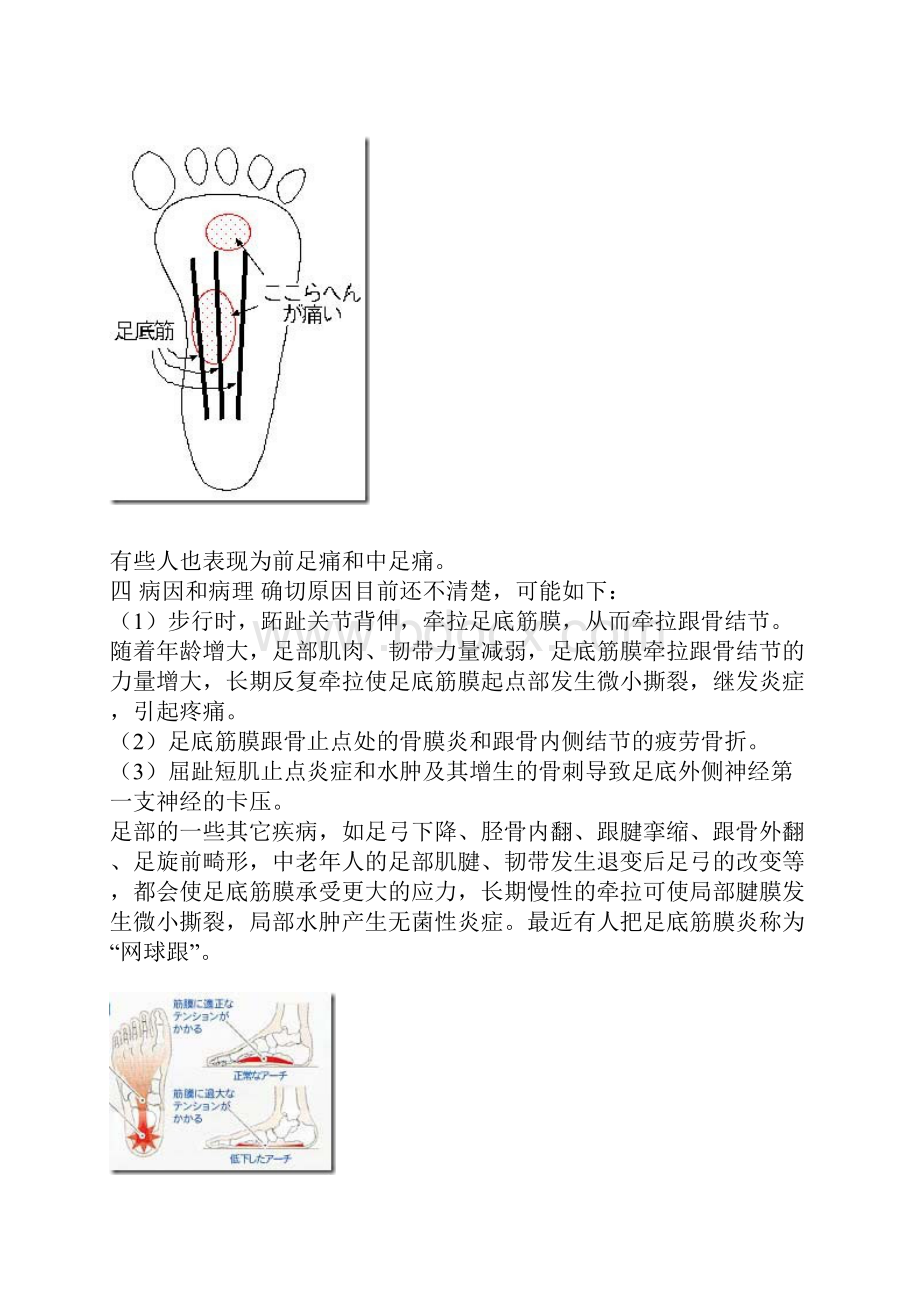 复健方法.docx_第2页