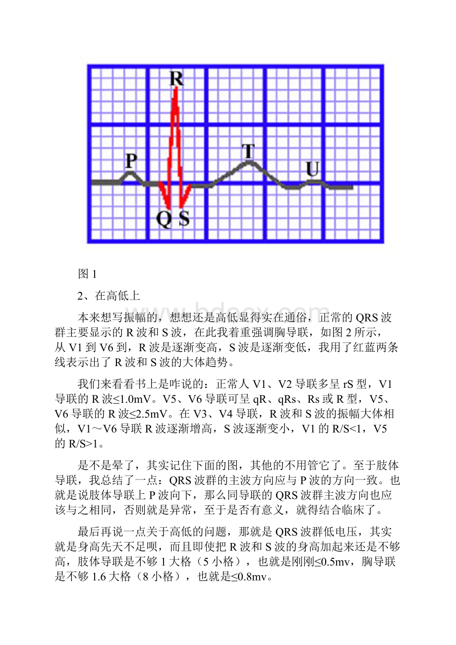 心电图QRS波群地五种.docx_第2页