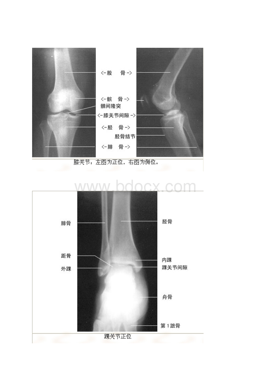 最全影像解剖影像图谱珍藏版.docx_第3页