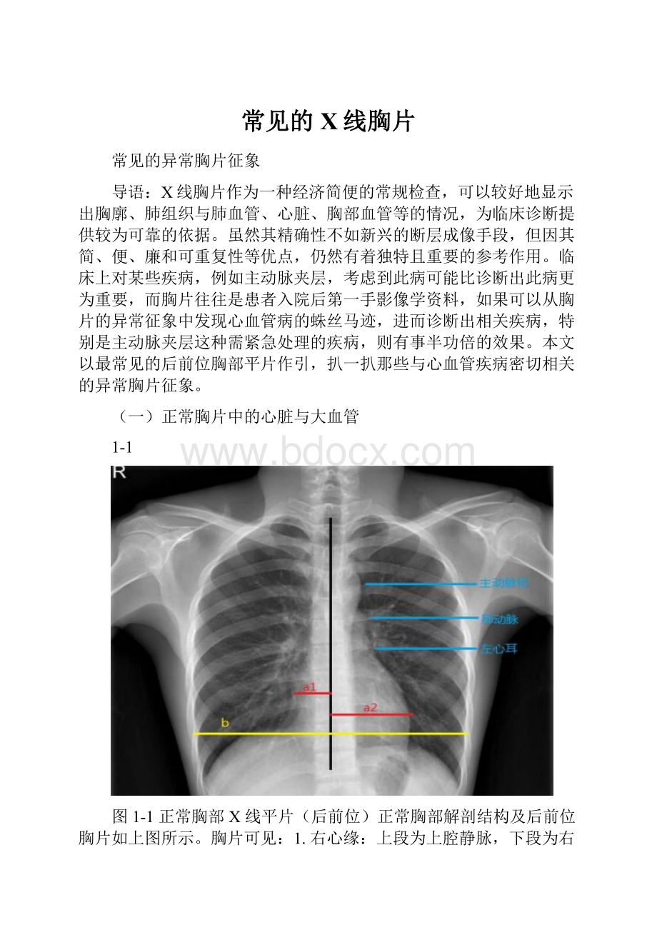 常见的X线胸片.docx_第1页