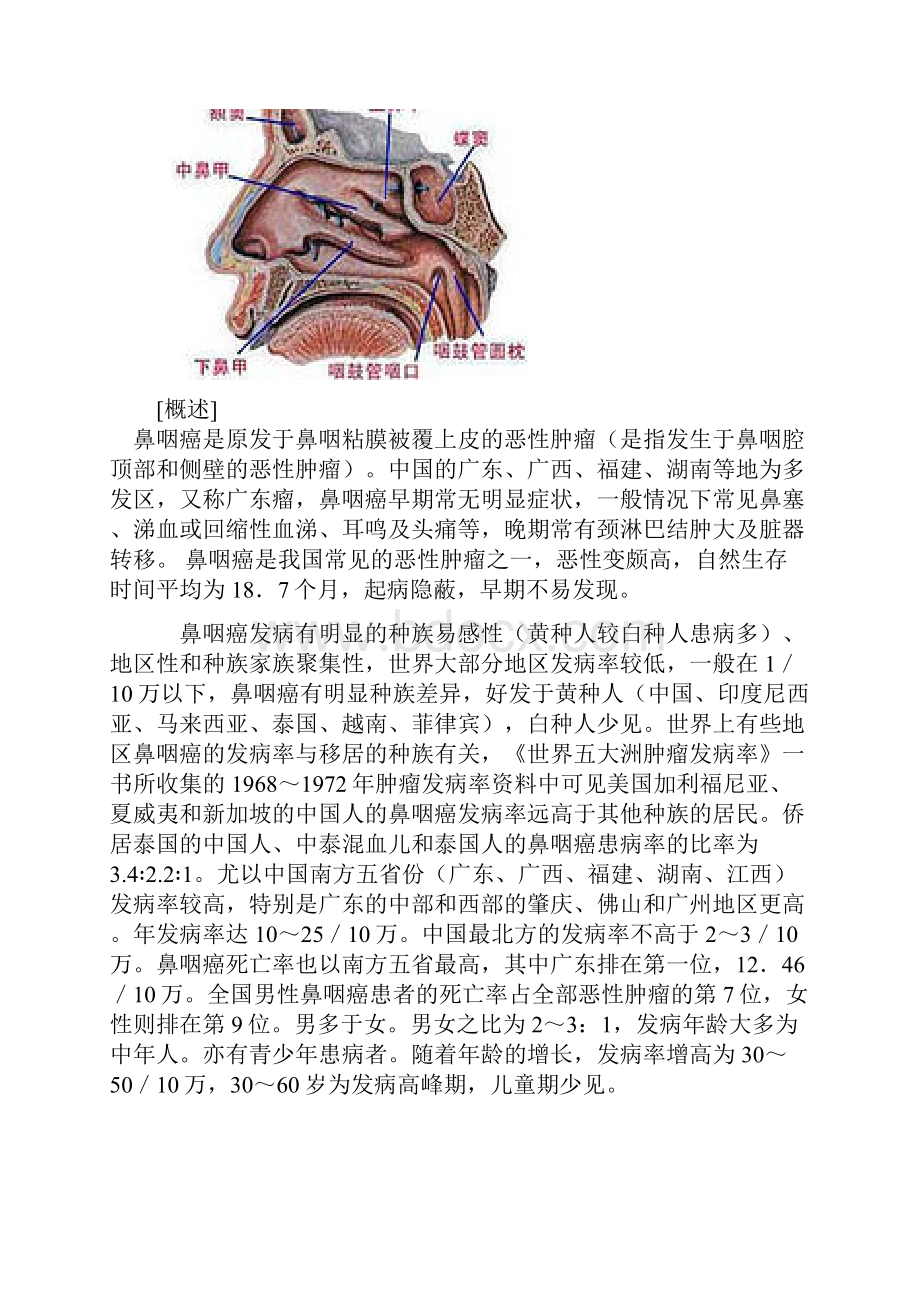 鼻咽癌综述.docx_第2页