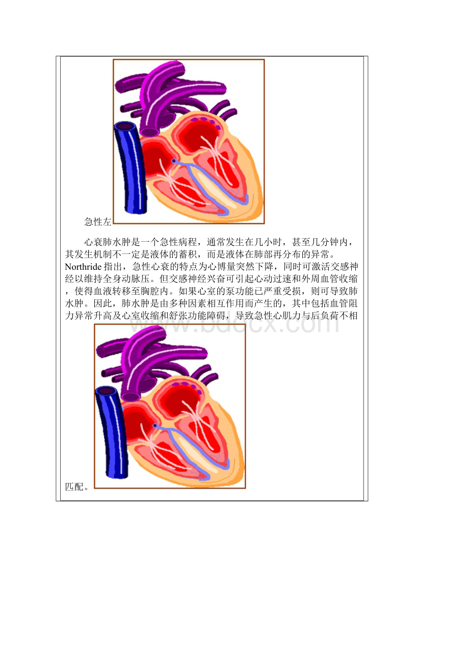 心衰患者围麻醉期管理制度.docx_第3页