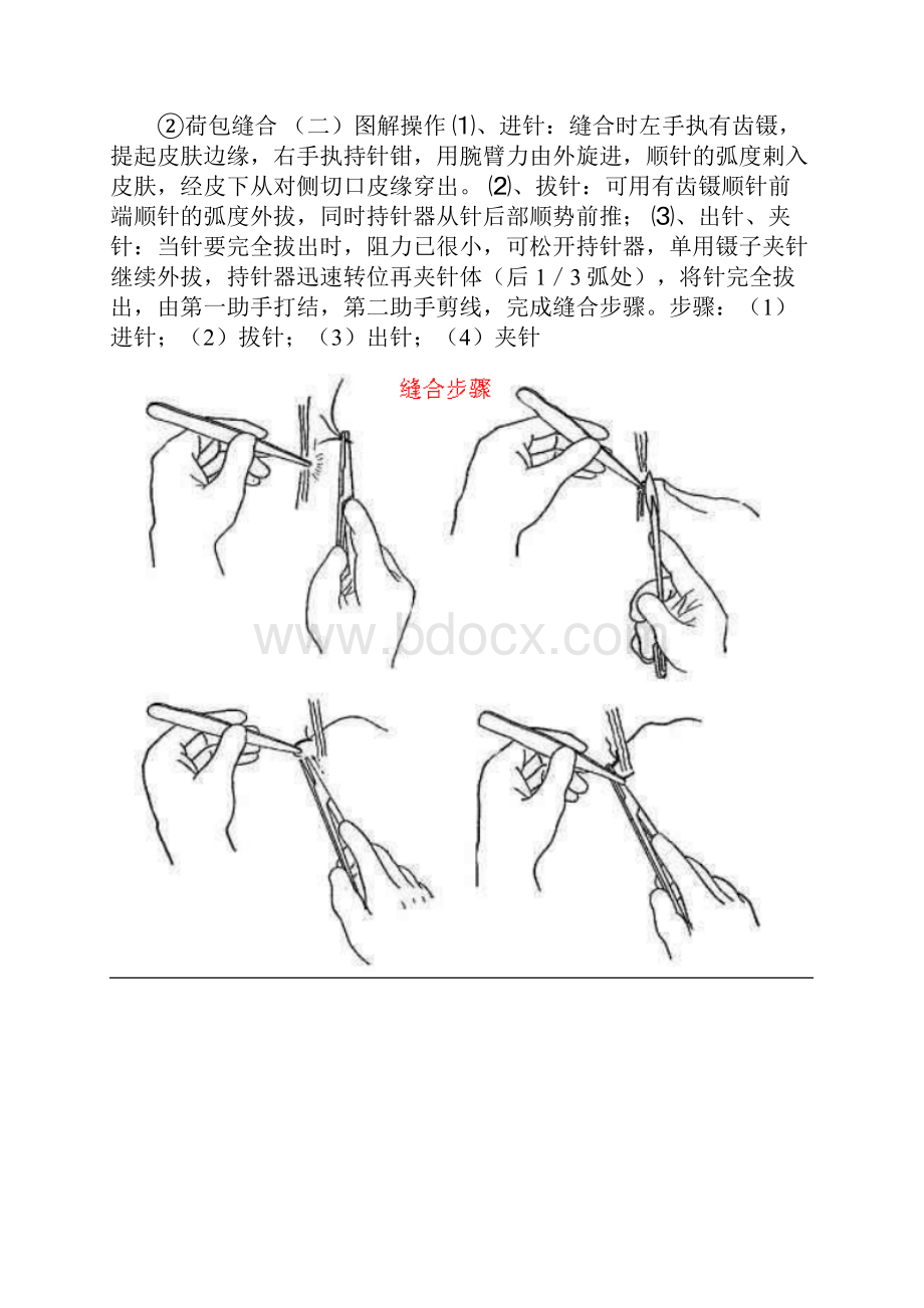 外科基础缝合法.docx_第2页