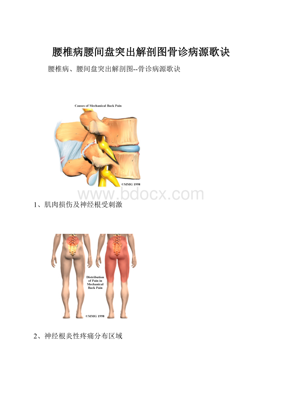 腰椎病腰间盘突出解剖图骨诊病源歌诀.docx_第1页