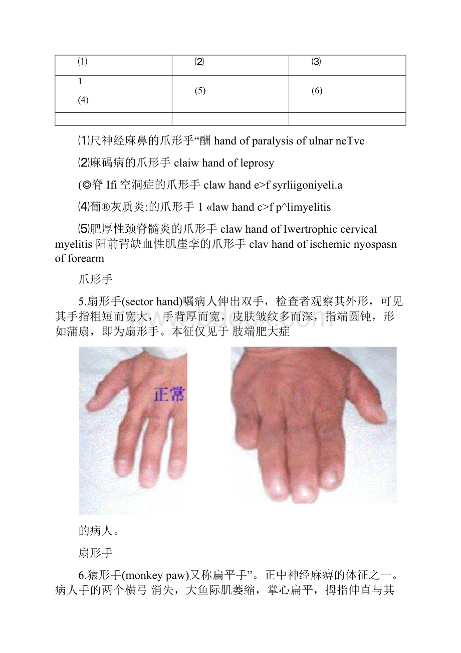 体格检查四肢与关节检查7.docx_第3页