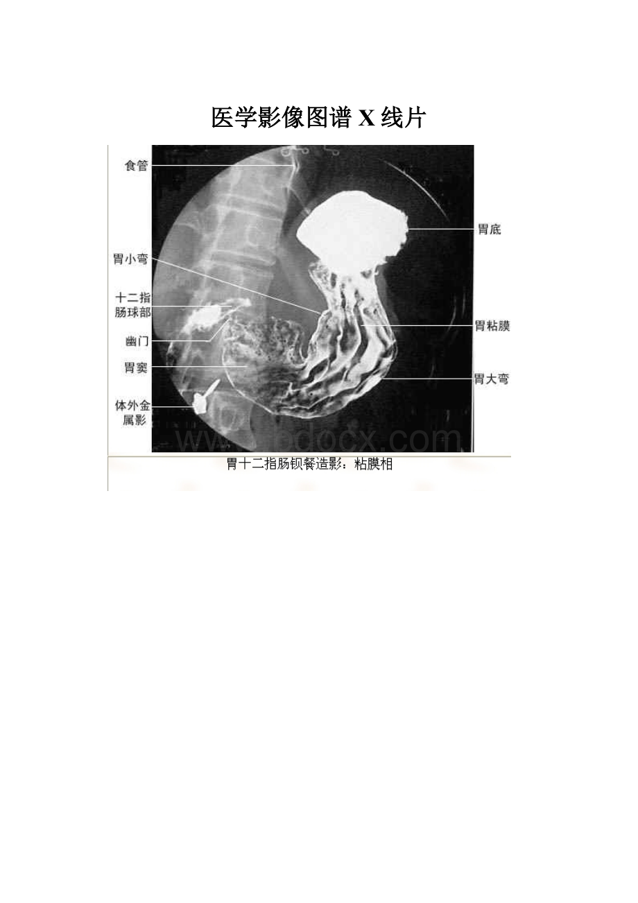 医学影像图谱X线片.docx_第1页