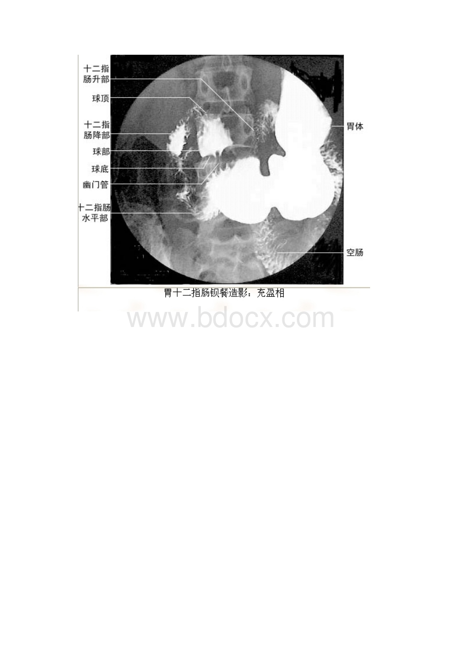 医学影像图谱X线片.docx_第2页
