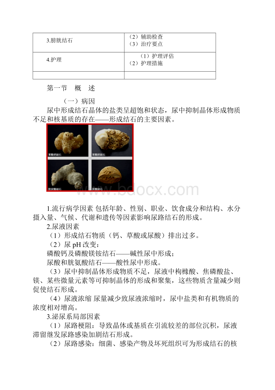 主管护师外科讲义第三十八章 泌尿系结石病人的护理.docx_第2页