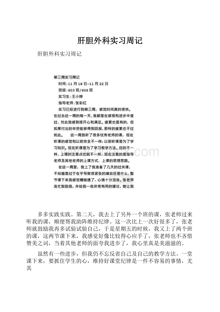 肝胆外科实习周记.docx