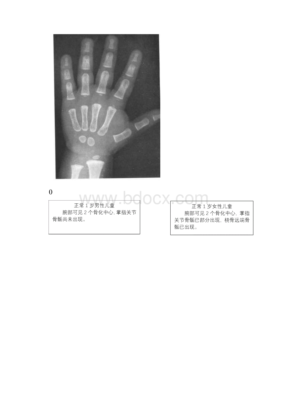 骨龄之对照实用实用标准.docx_第2页