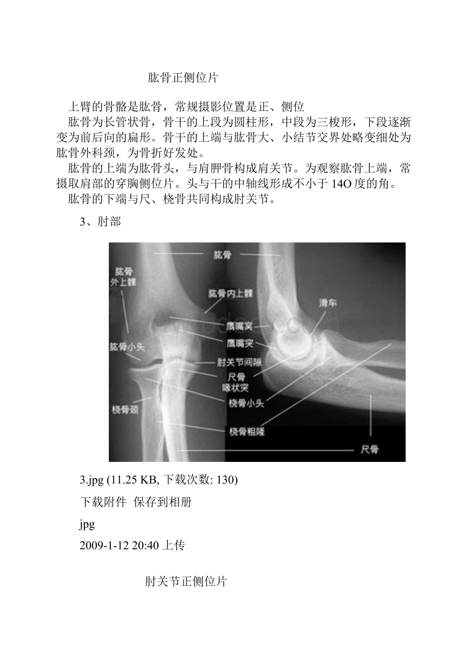 fy骨影像常用解剖.docx_第3页