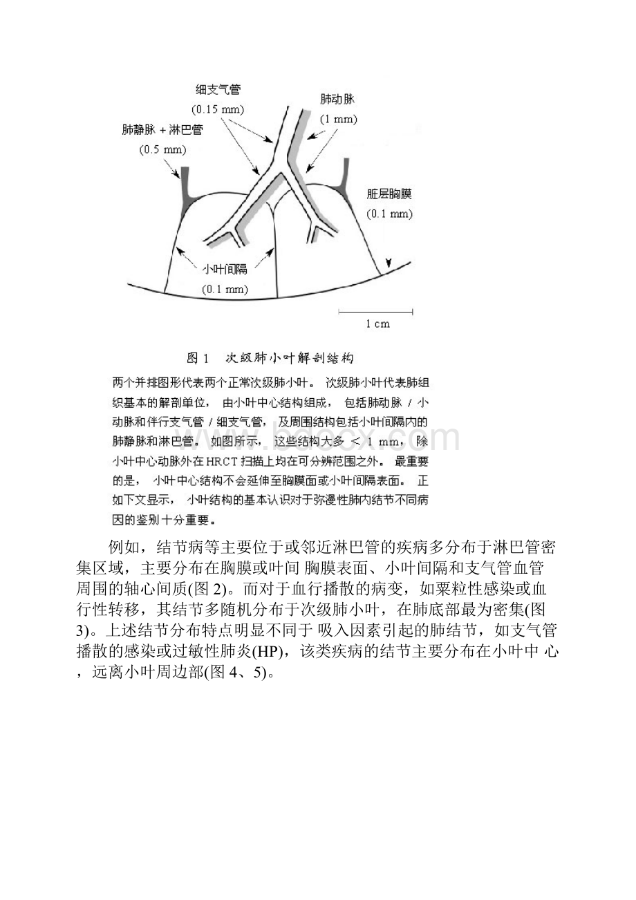 肺内多发结节的HRCT诊断及鉴别诊断流程图.docx_第2页