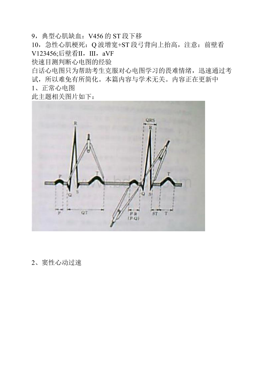 巧记心电图解读.docx_第2页