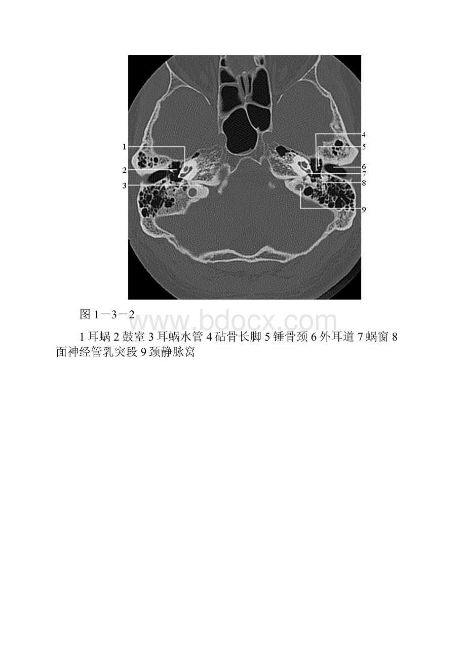 颞骨正常CT解剖附图.docx_第2页