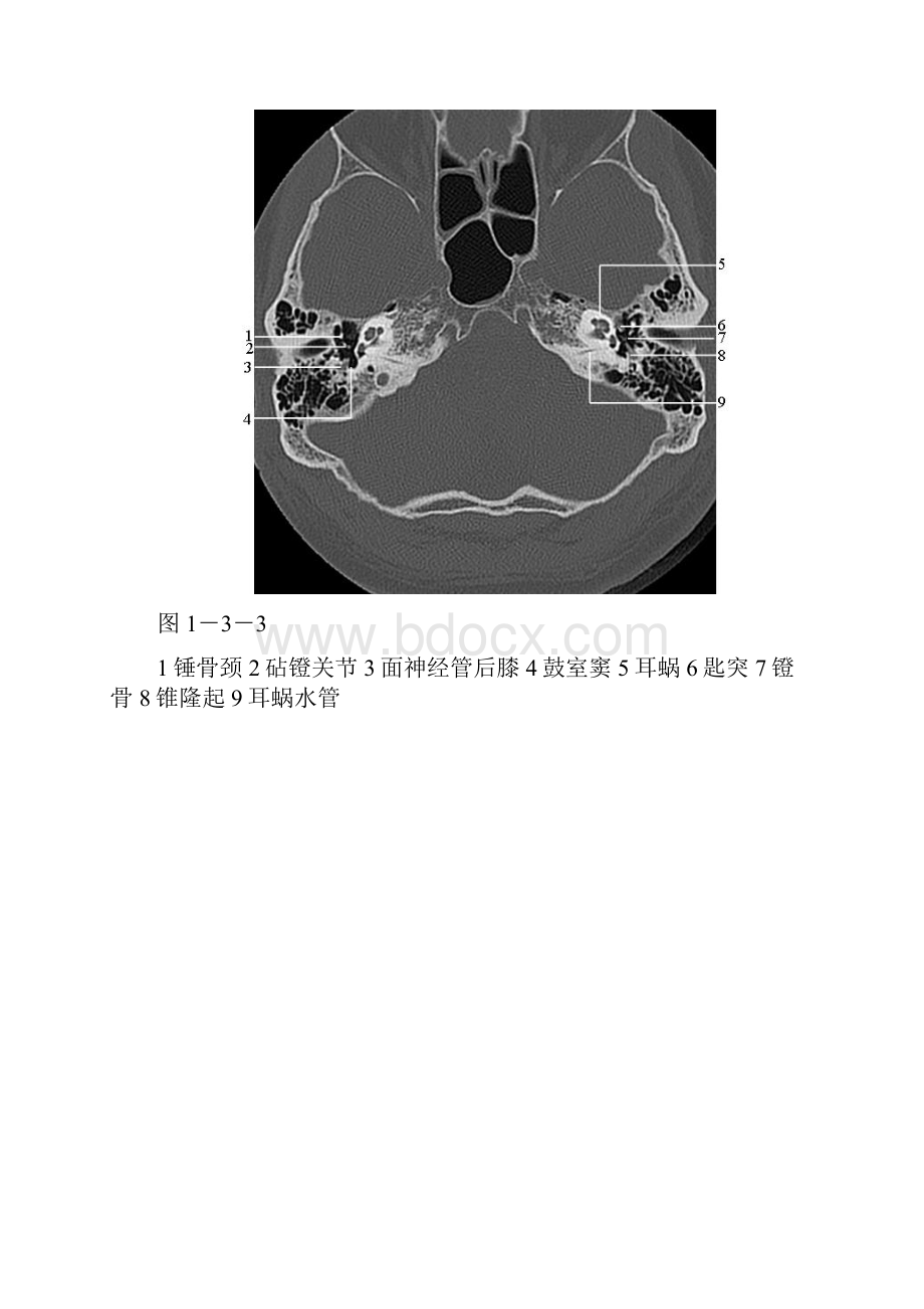 颞骨正常CT解剖附图.docx_第3页