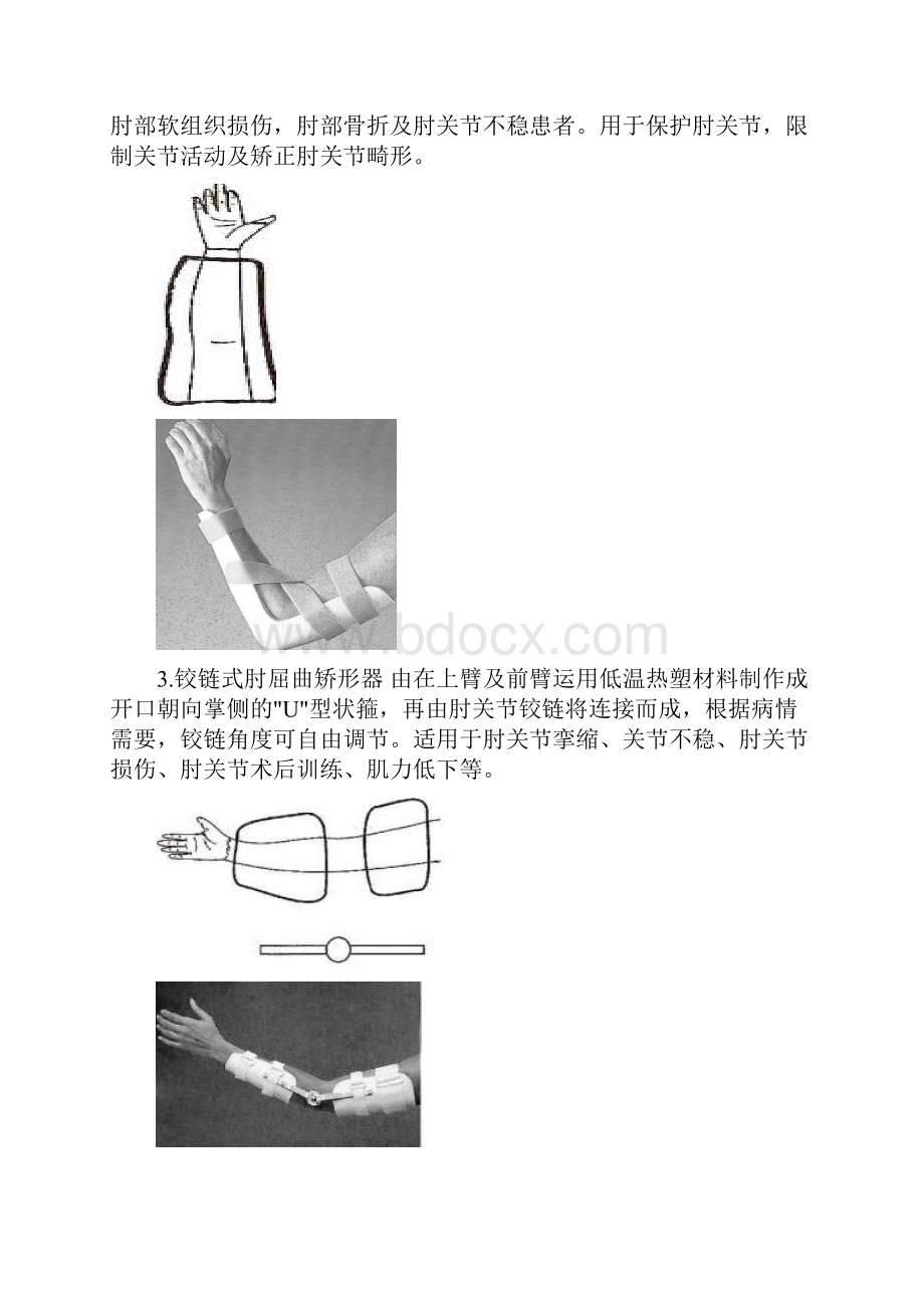 项目九矫形器3常用低温热塑矫形器.docx_第2页