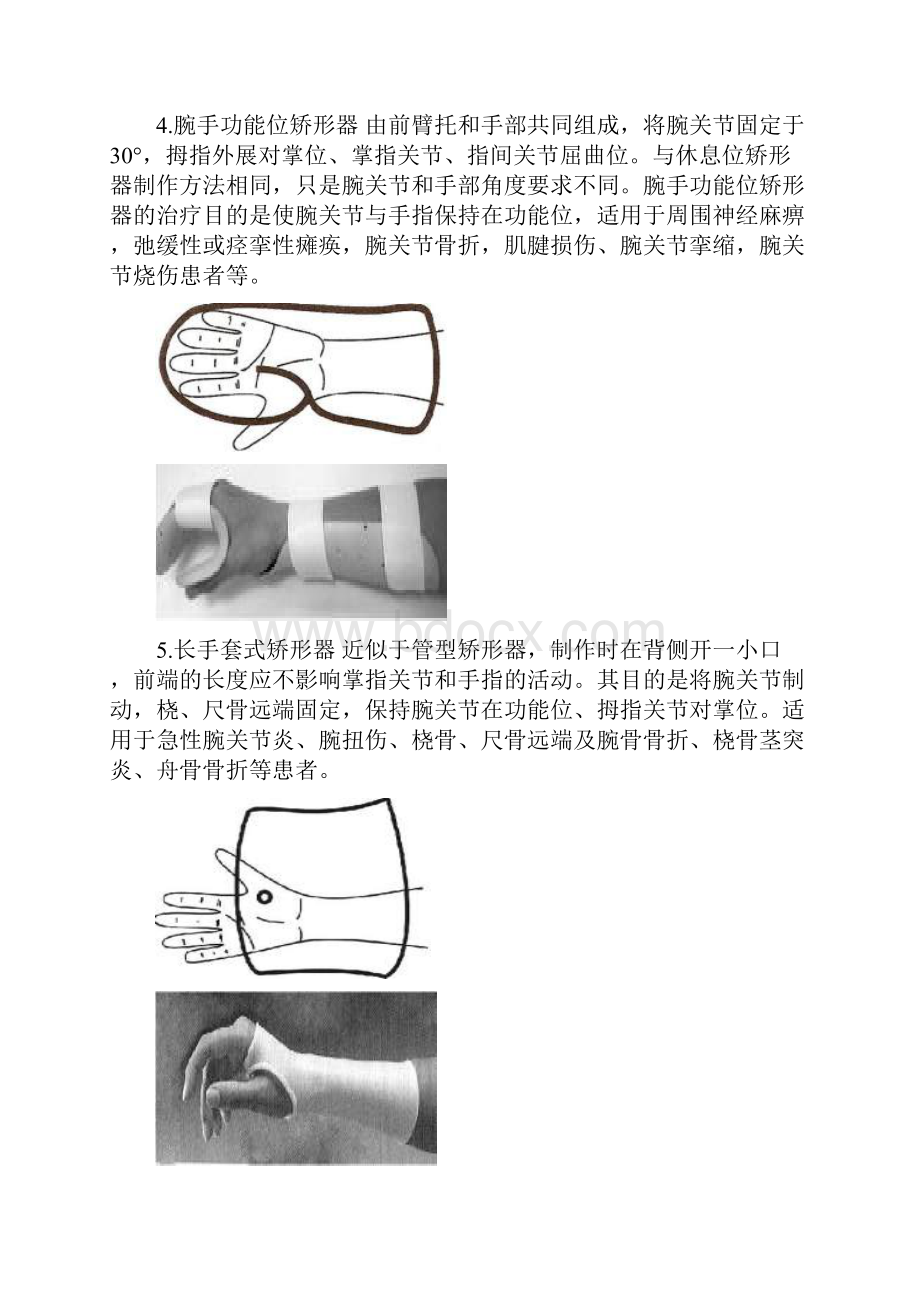 项目九矫形器3常用低温热塑矫形器.docx_第3页