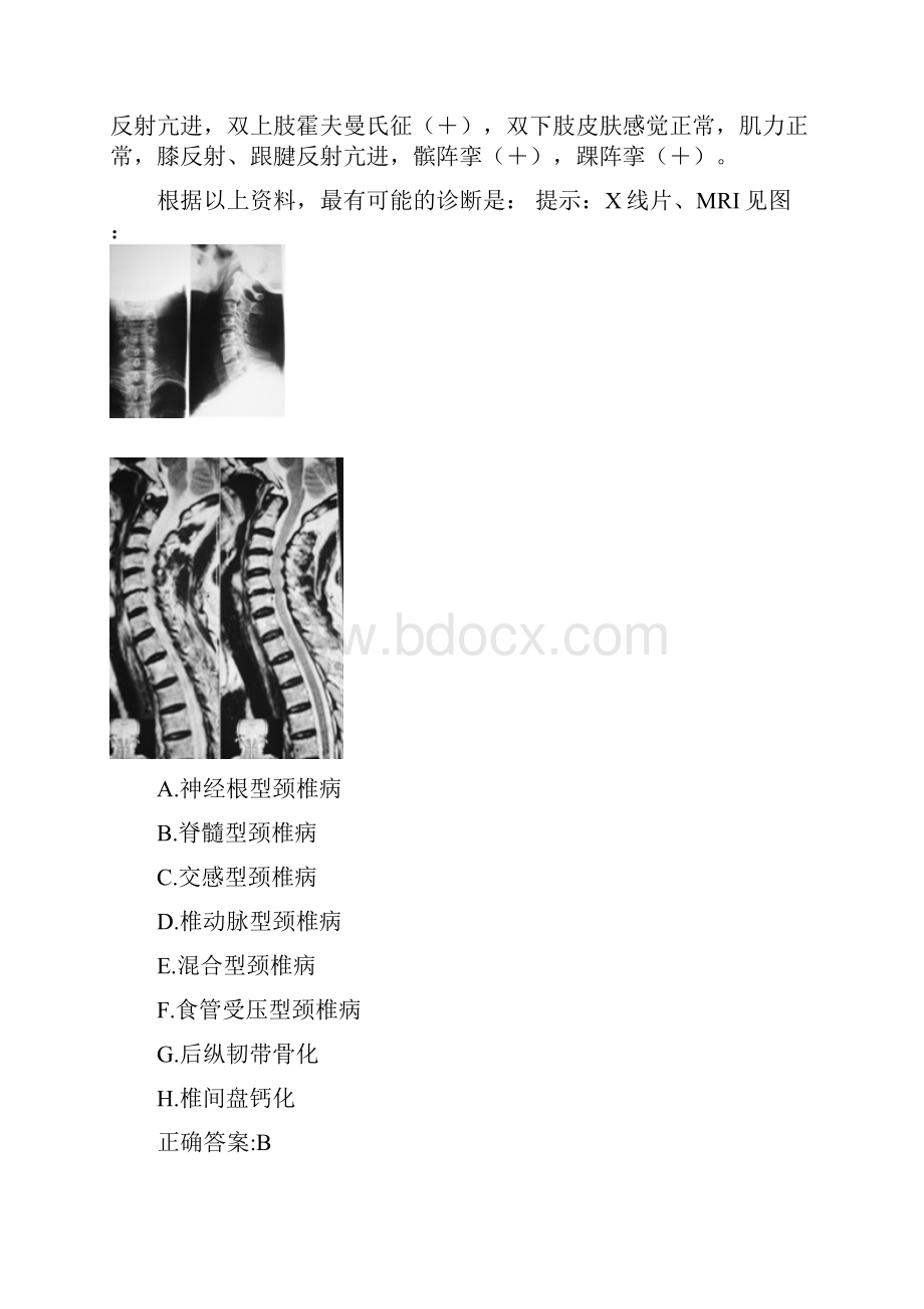 外科高级职称考前冲刺一.docx_第3页