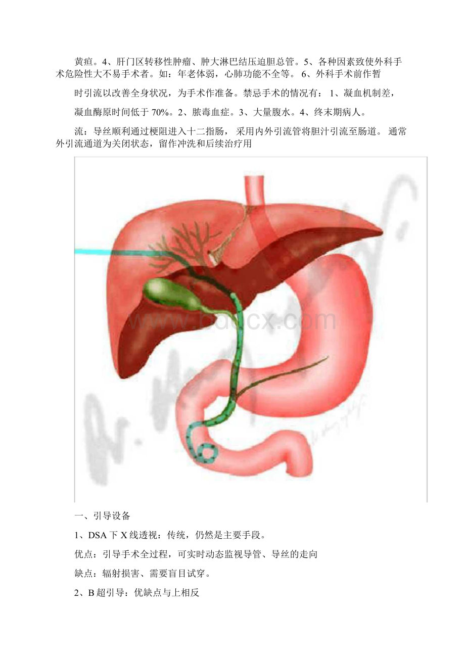 经皮穿刺肝胆管引流术.docx_第2页