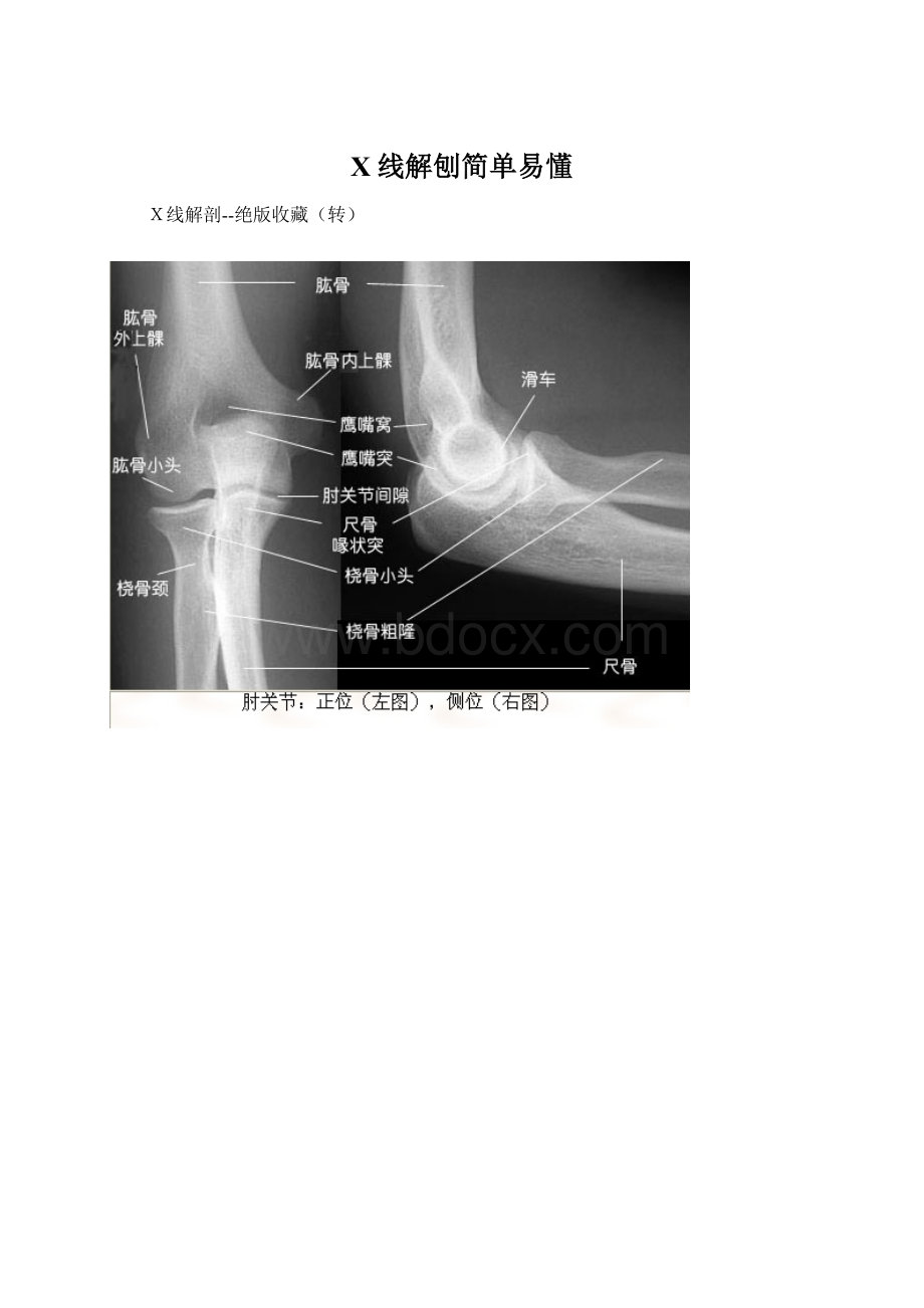 X线解刨简单易懂.docx_第1页