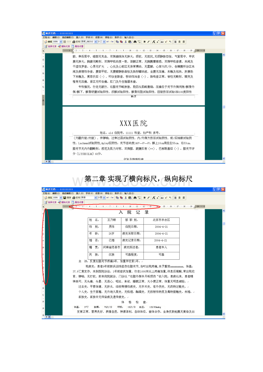 病历宝典版本更新功能.docx_第2页