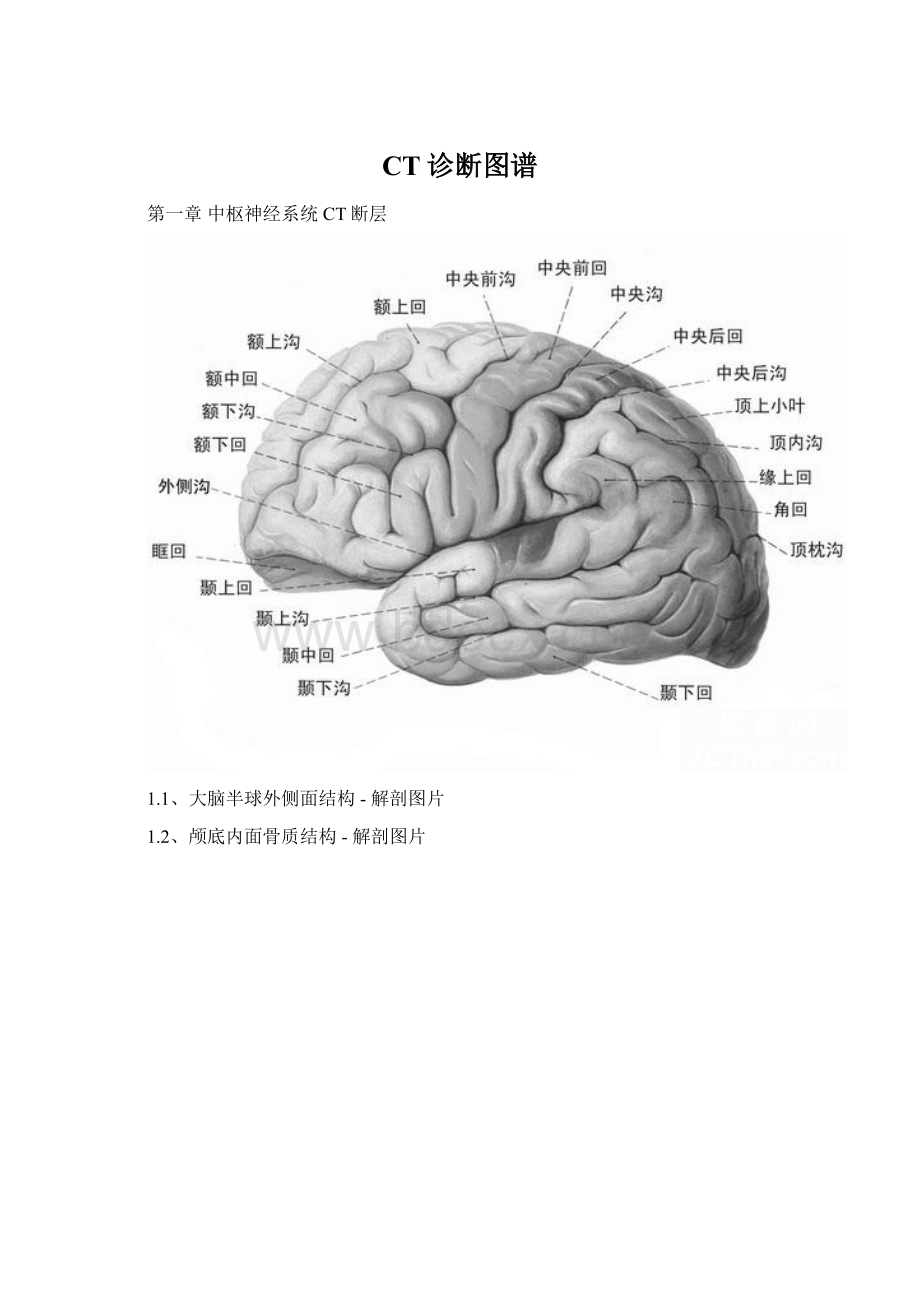 CT诊断图谱.docx_第1页