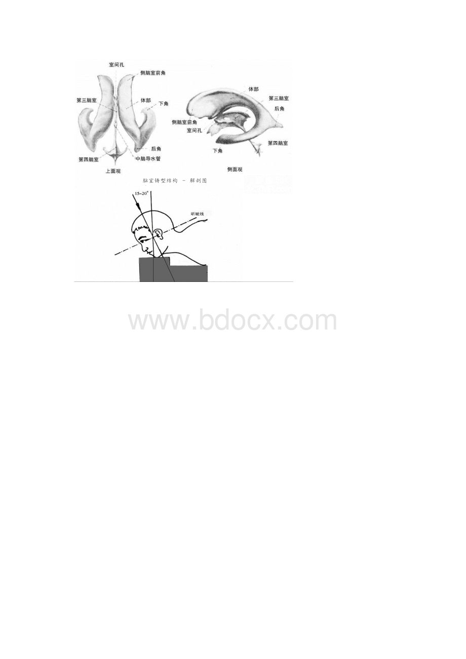 CT诊断图谱.docx_第2页