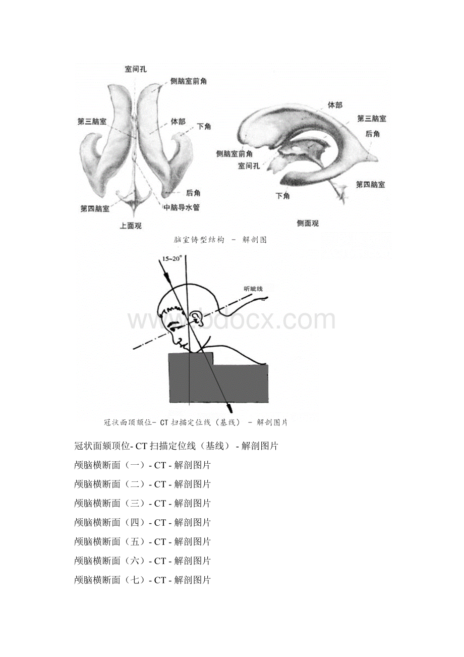 CT诊断图谱.docx_第3页