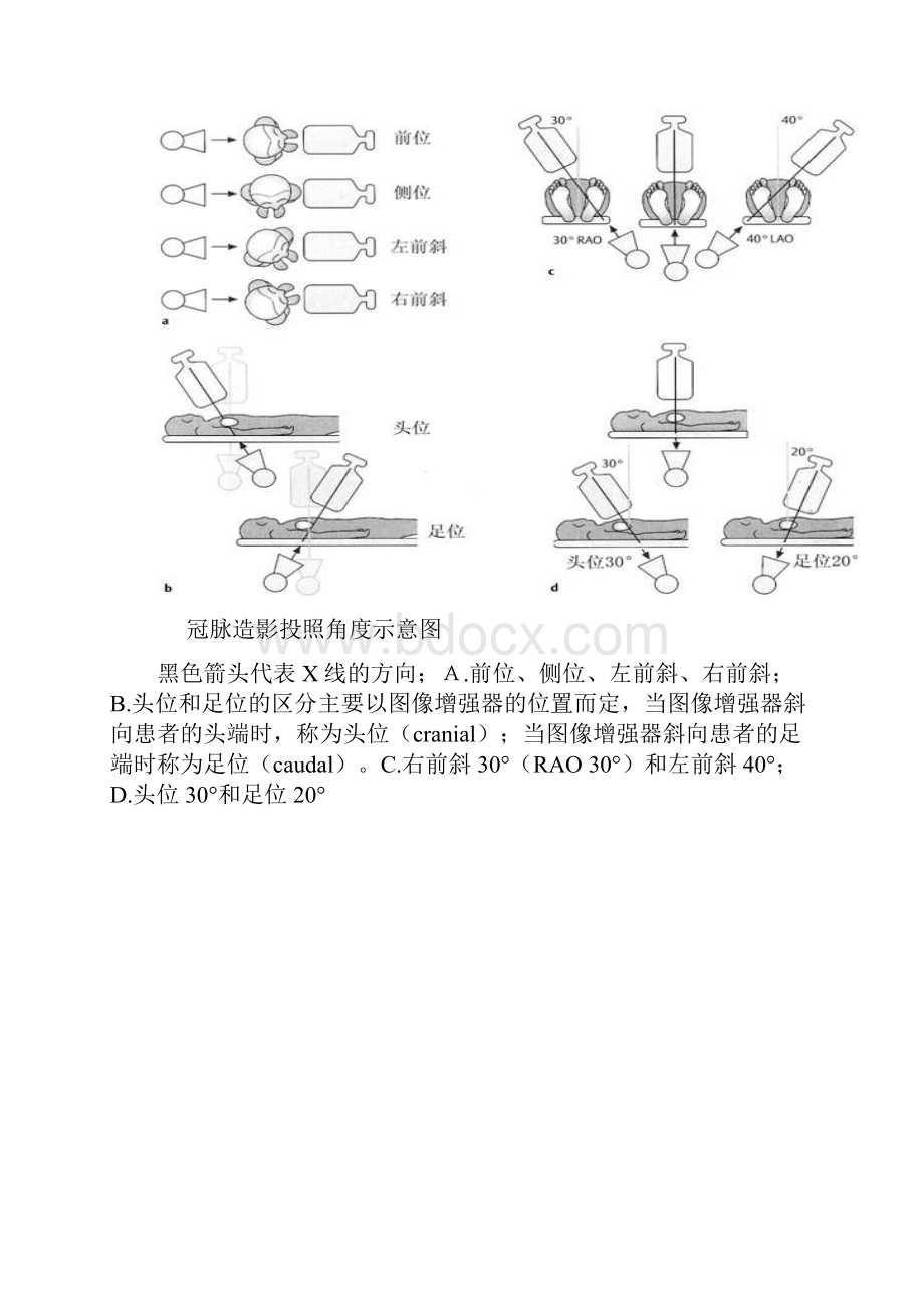 冠状动脉造影体位图片.docx_第3页