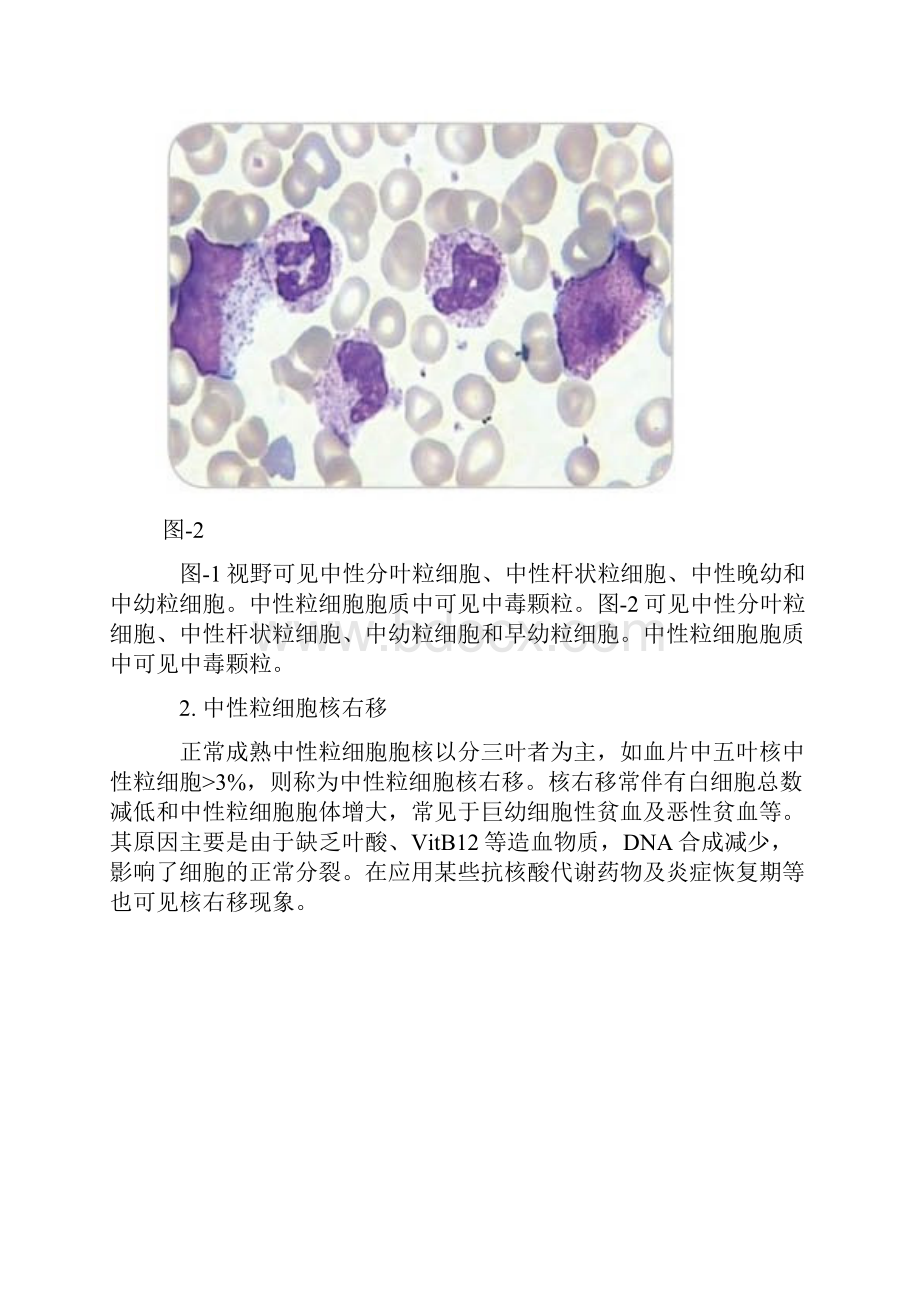 末梢血涂片白细胞形态变化及临床意义.docx_第2页