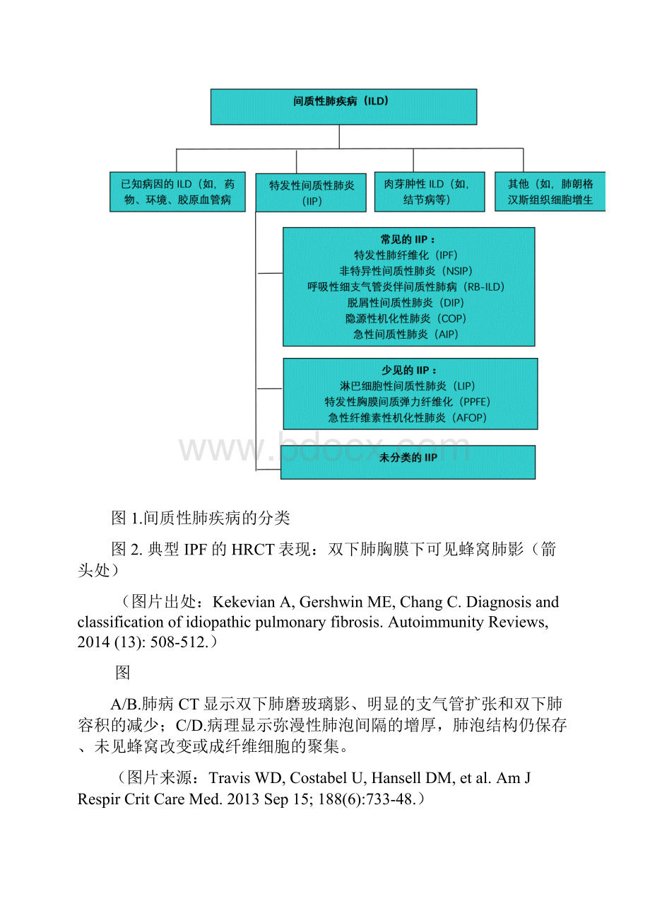 间质性肺病进展.docx_第3页