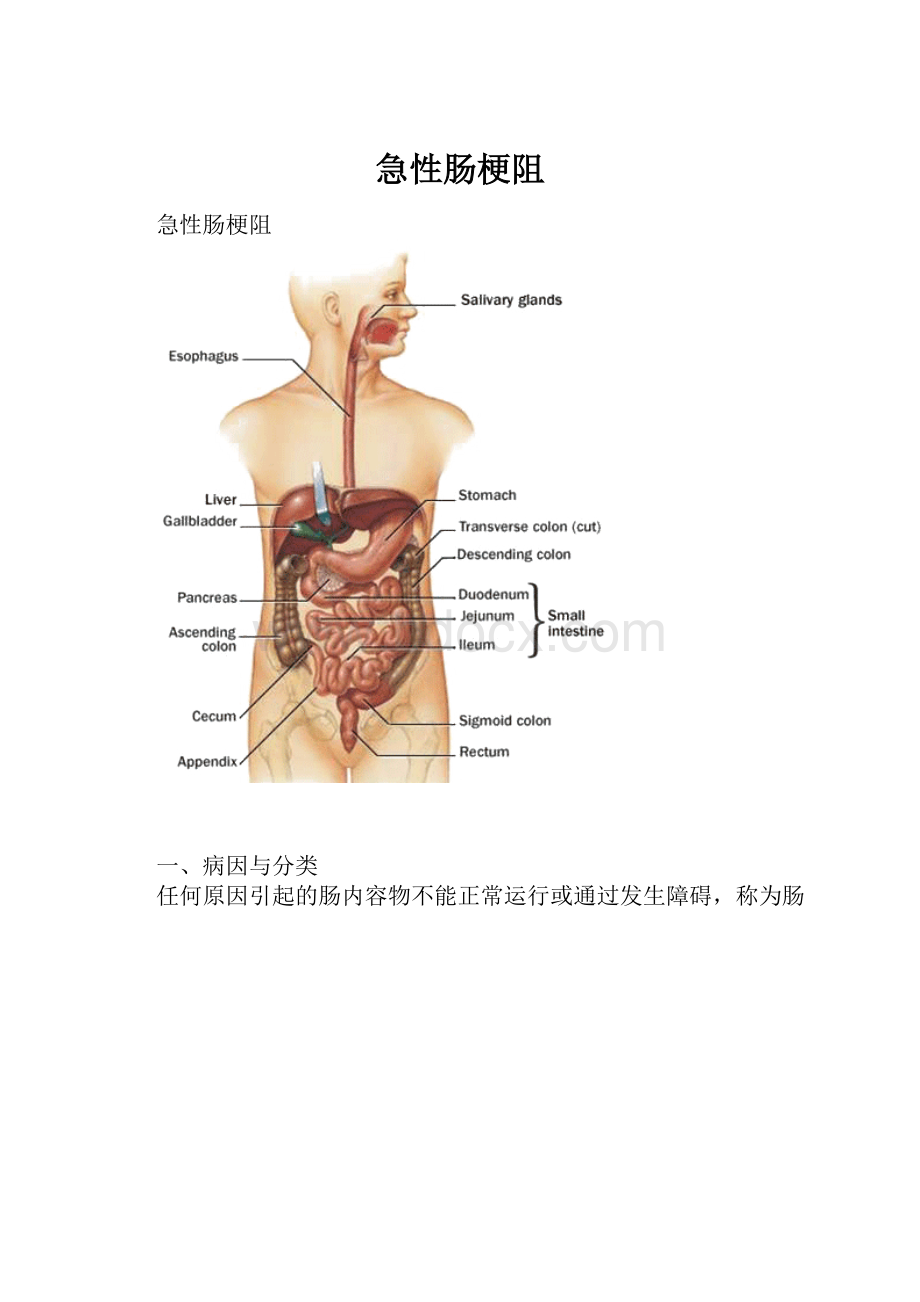 急性肠梗阻.docx