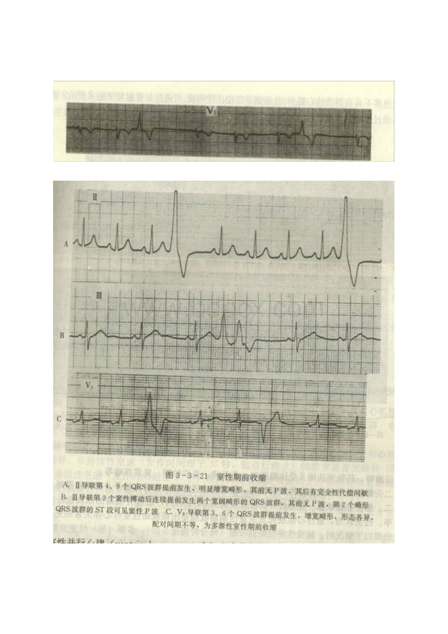 教你如何看懂心电图.docx_第3页