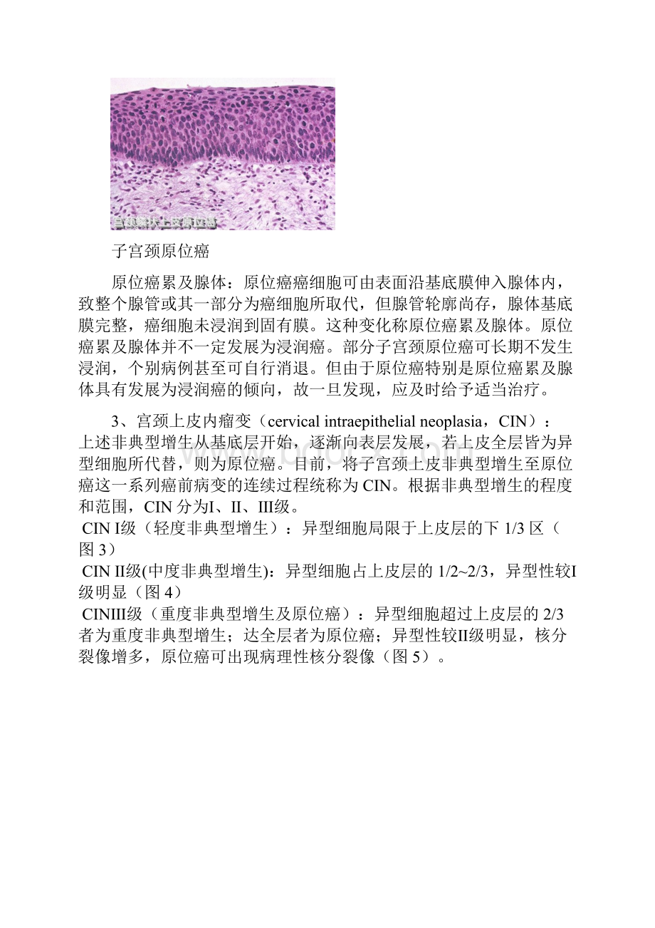 蚌埠医学院病理学教案.docx_第2页