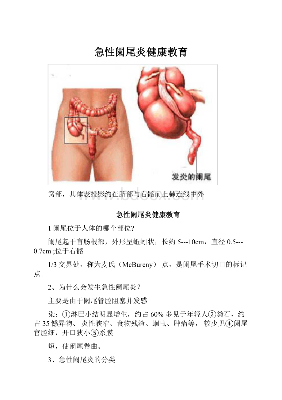 急性阑尾炎健康教育.docx_第1页